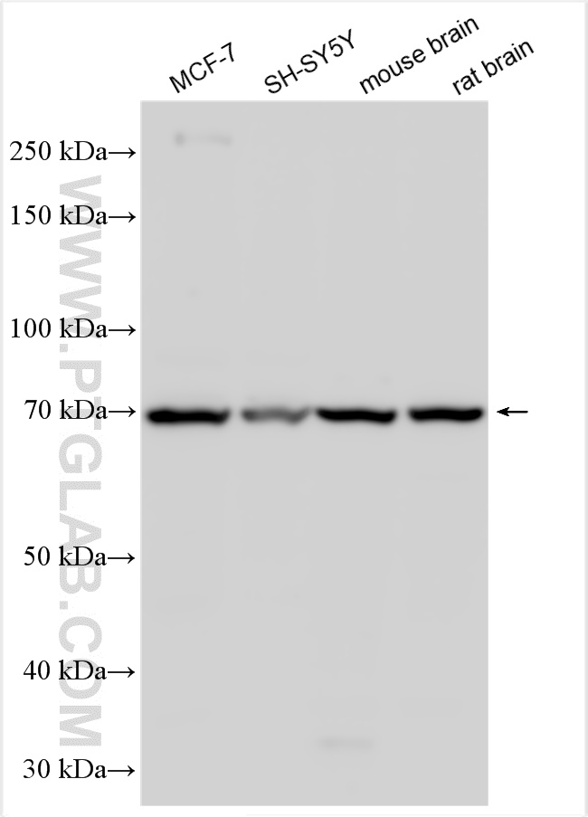 WB analysis using 10527-1-AP