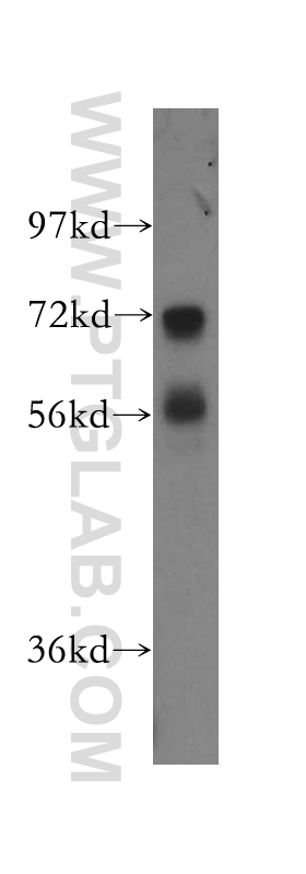 NRG1, isoform SMDF Polyclonal antibody