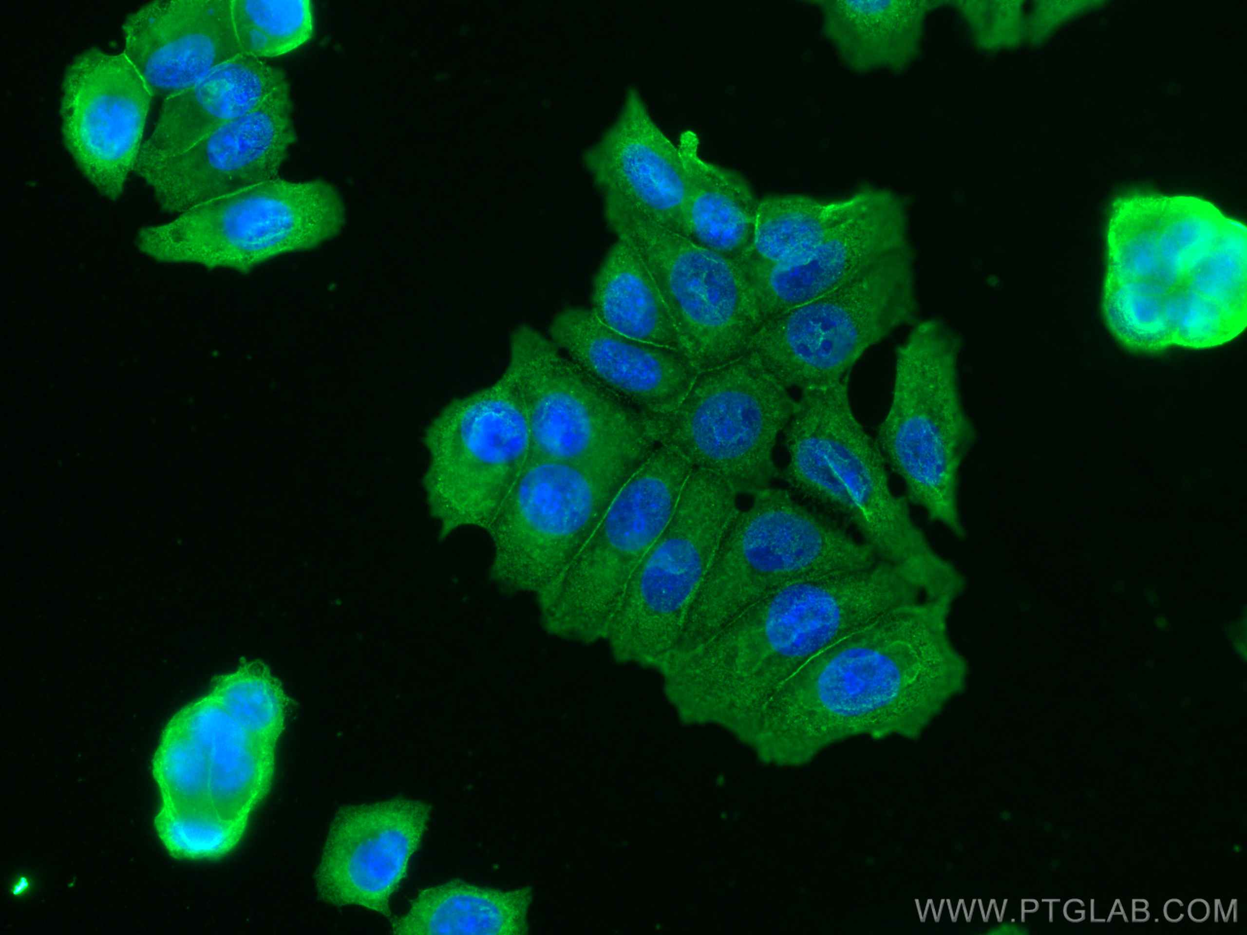 IF Staining of MCF-7 using 66492-1-Ig