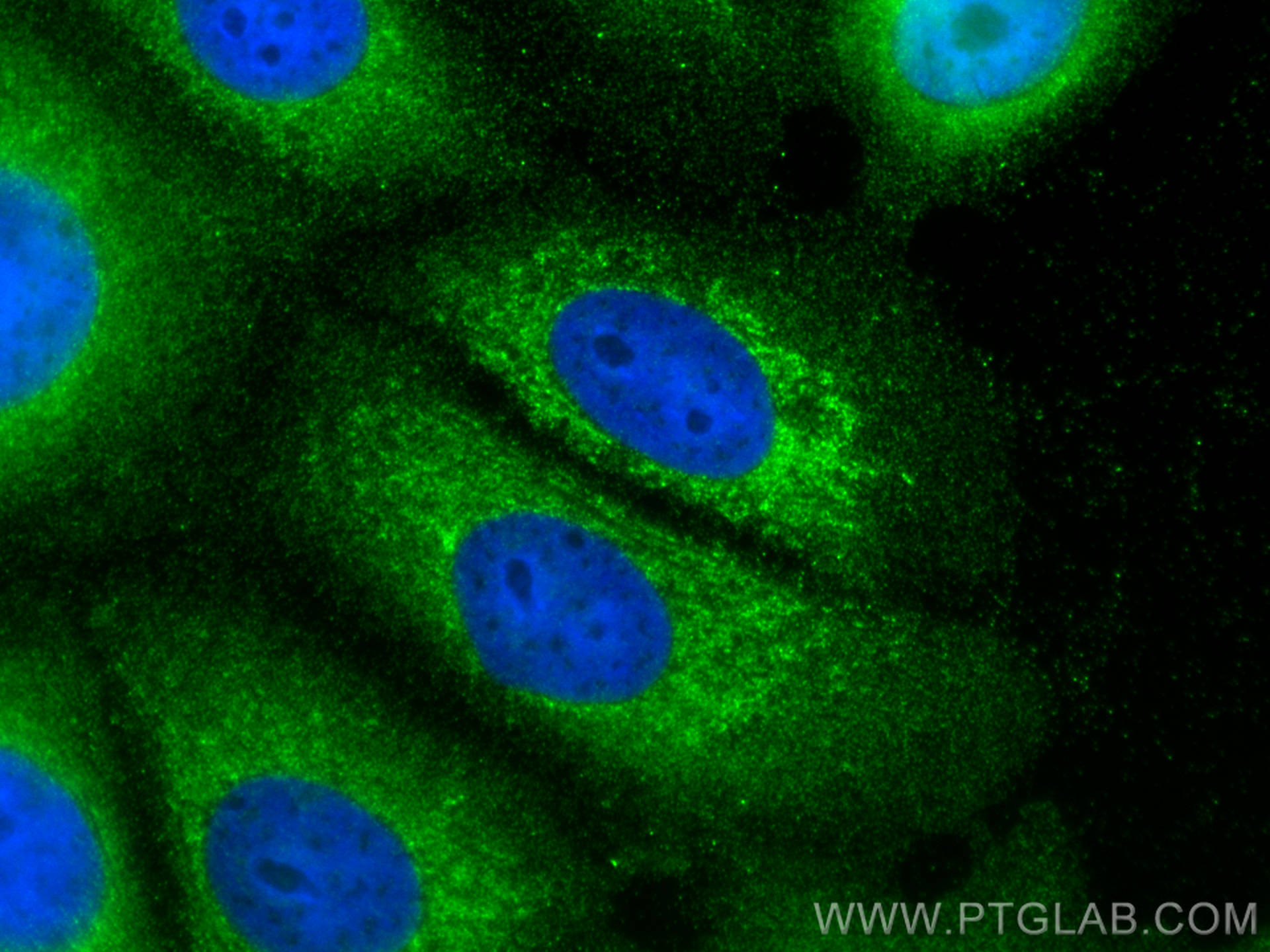 IF Staining of MCF-7 using 31043-1-AP