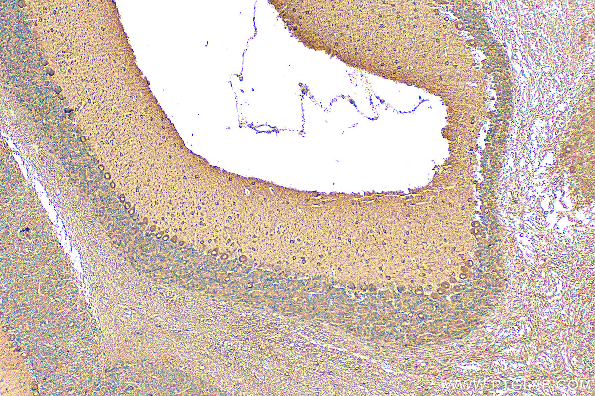 IHC staining of mouse cerebellum using 31043-1-AP