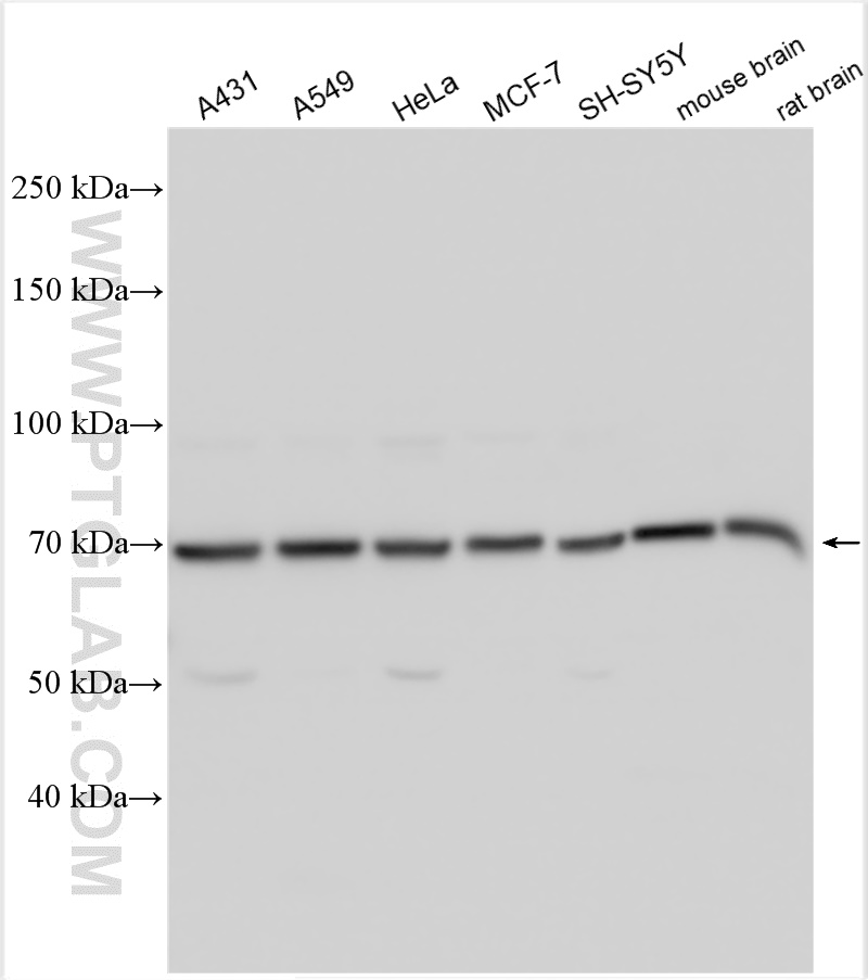 WB analysis using 31043-1-AP