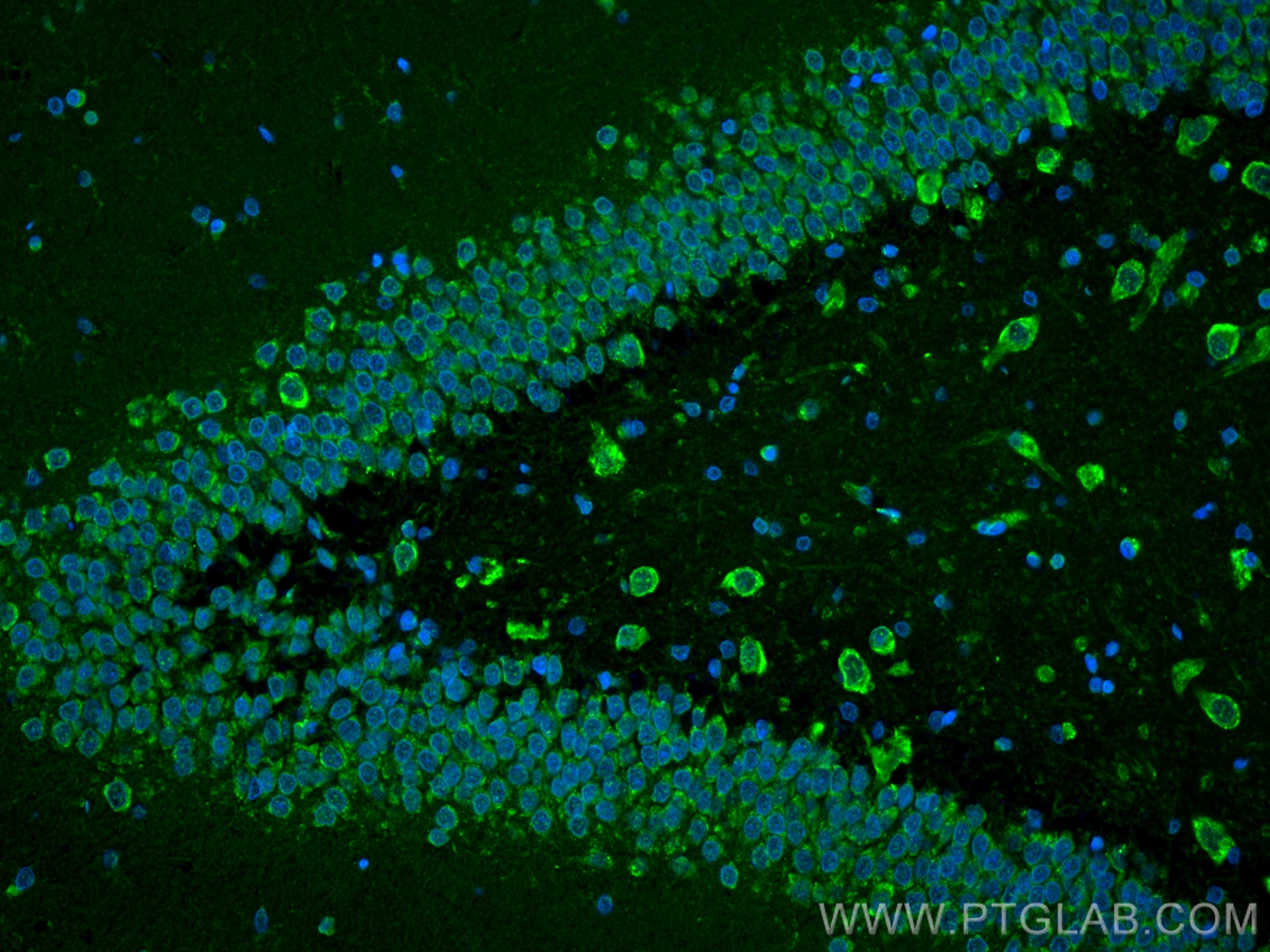 IF Staining of rat brain using 83251-2-RR