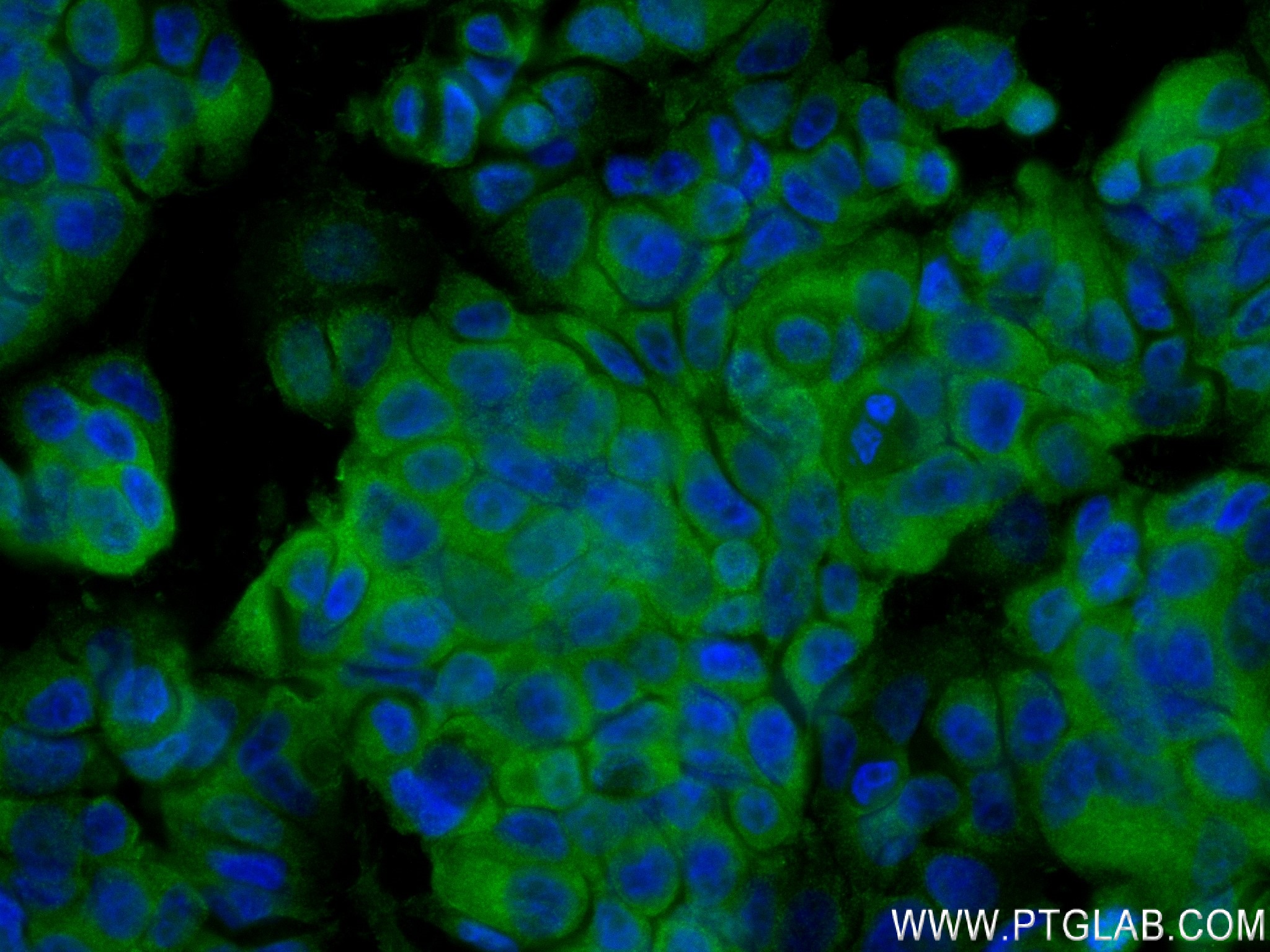 IF Staining of MCF-7 using 83323-6-RR (same clone as 83323-6-PBS)