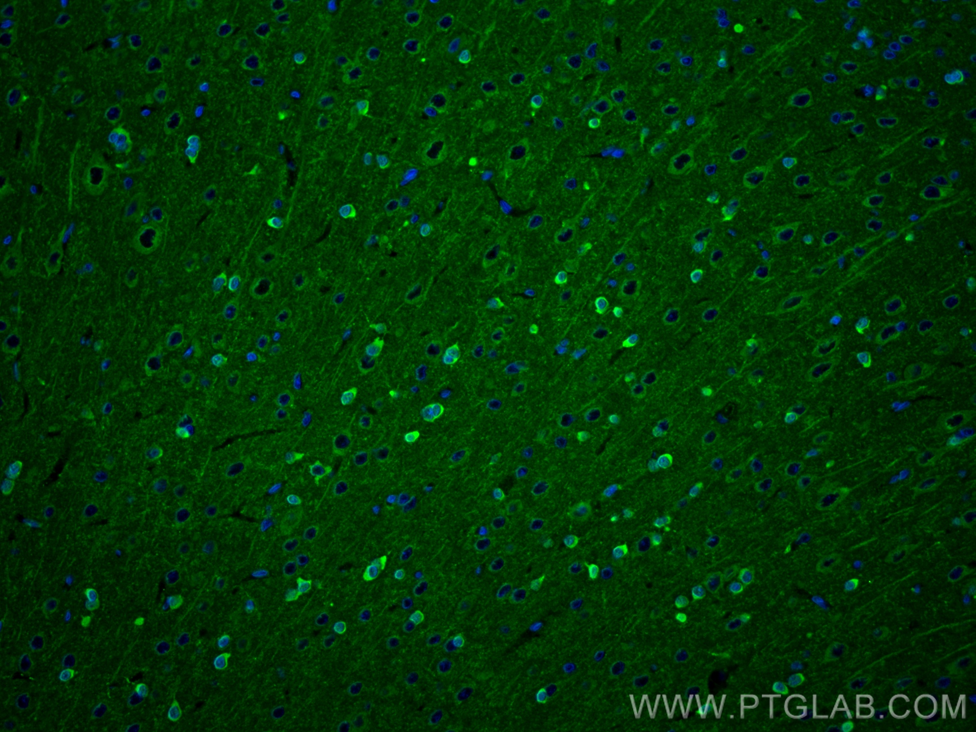 IF Staining of rat brain using 83323-6-RR (same clone as 83323-6-PBS)