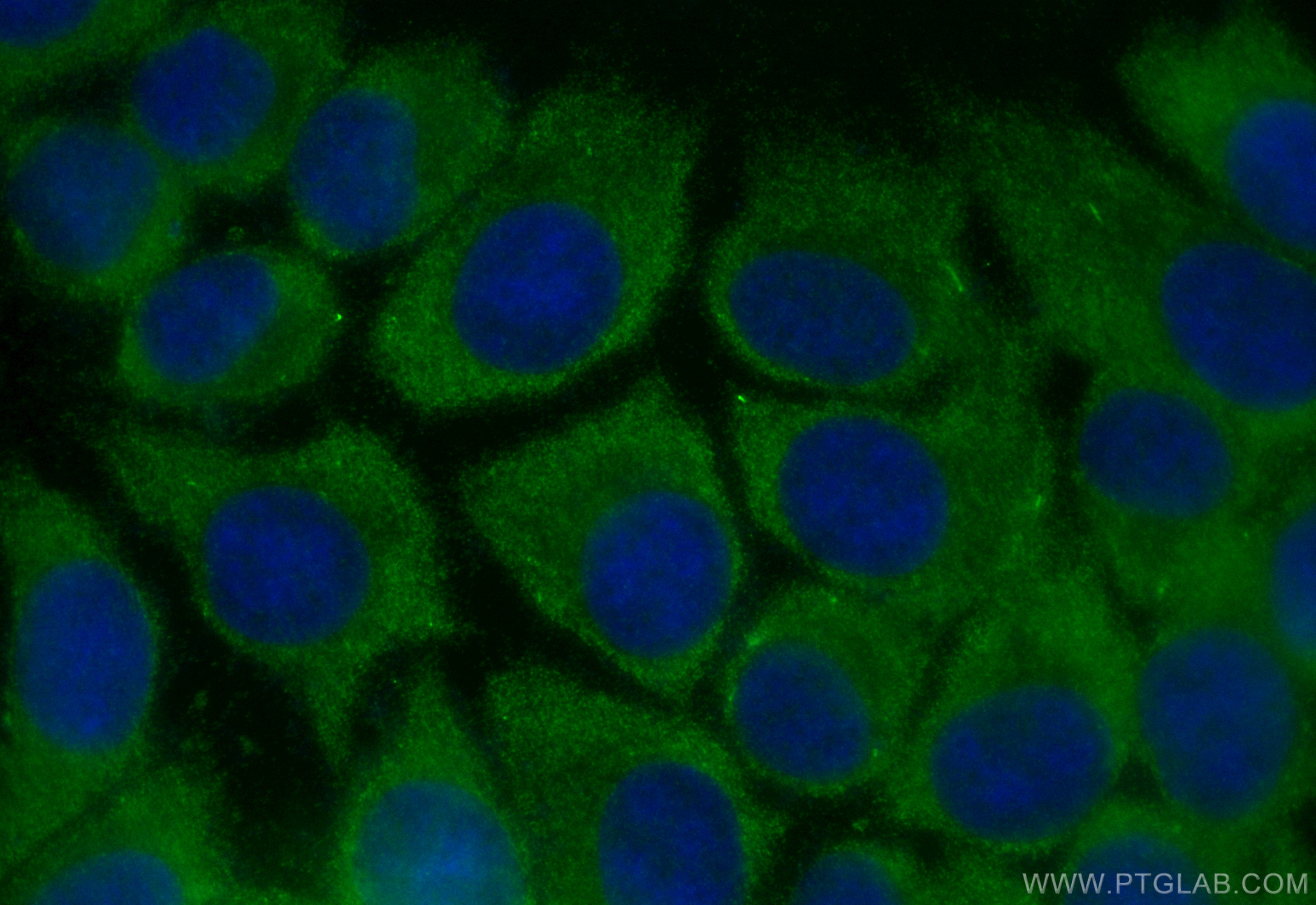 IF Staining of MCF-7 using CL488-83323-6