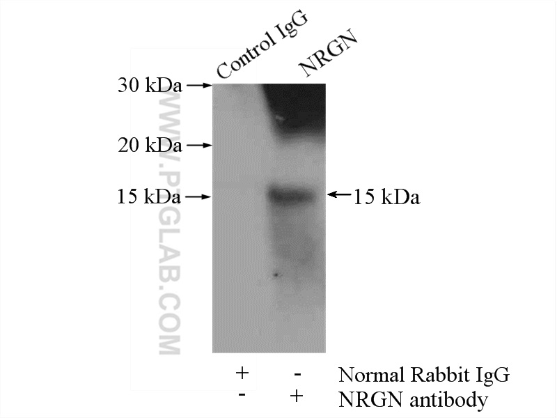 IP experiment of mouse brain using 10440-1-AP