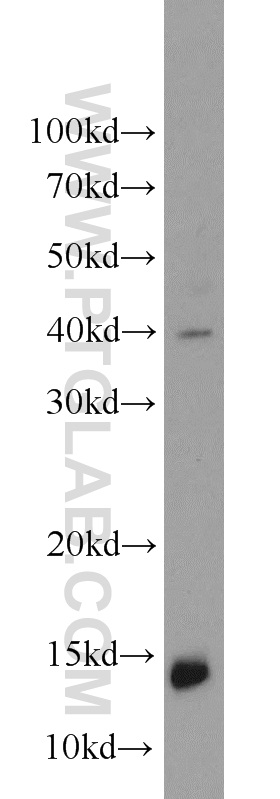 WB analysis of mouse brain using 10440-1-AP