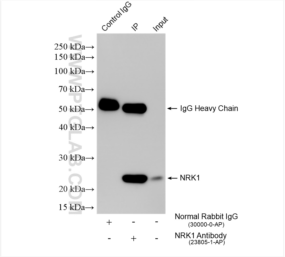 IP experiment of mouse kidney using 23805-1-AP IP experiment of mouse kidney using 23805-1-AP