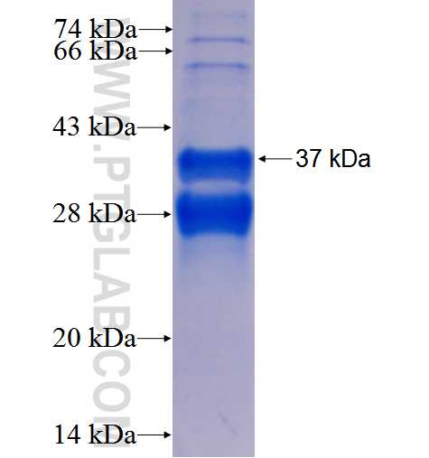 NRM fusion protein Ag25501 SDS-PAGE