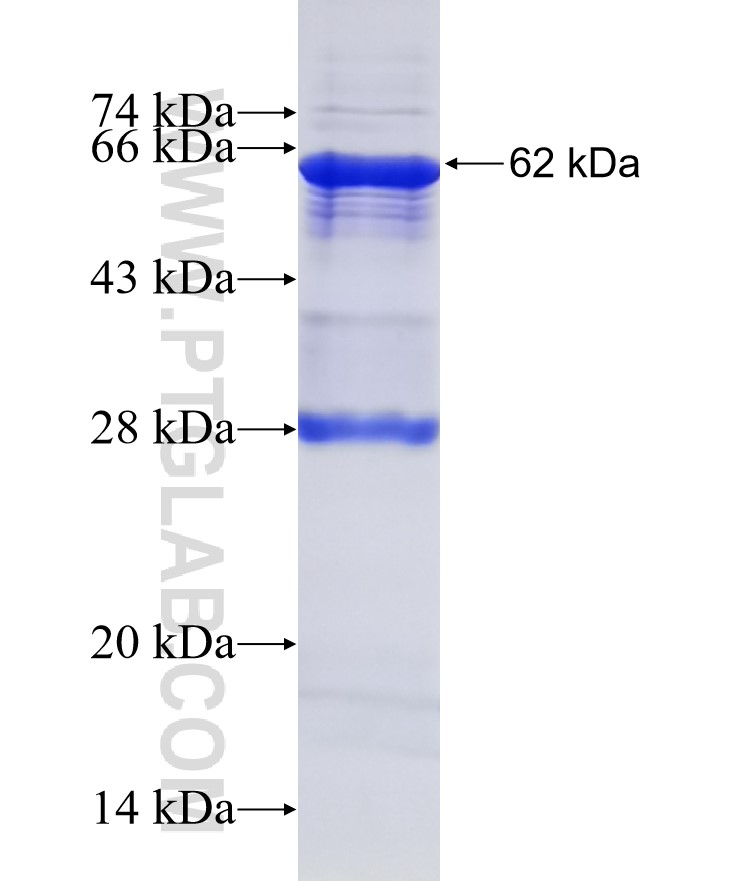 NRP1 fusion protein Ag0931 SDS-PAGE