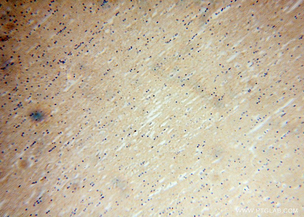 IHC staining of human brain using 17574-1-AP