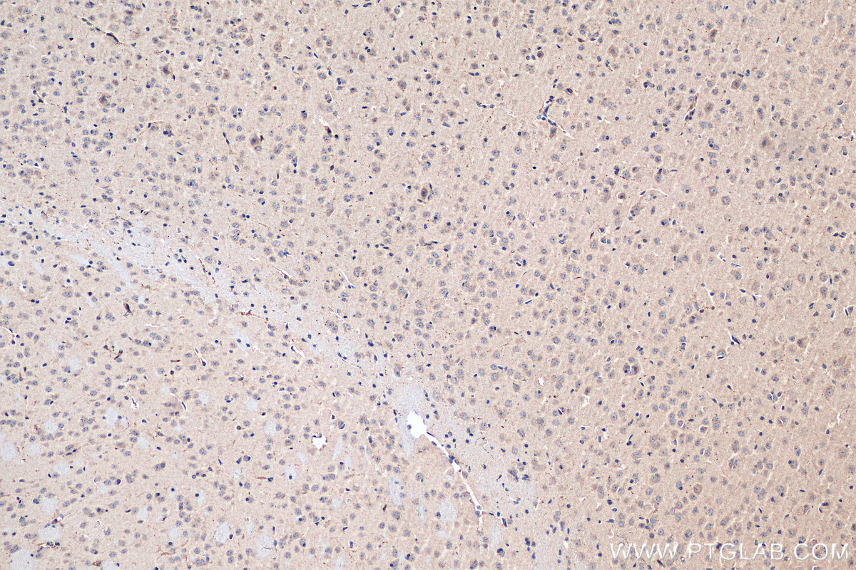IHC staining of mouse brain using 19709-1-AP