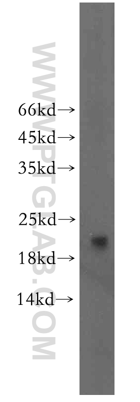 WB analysis of human liver using 19709-1-AP