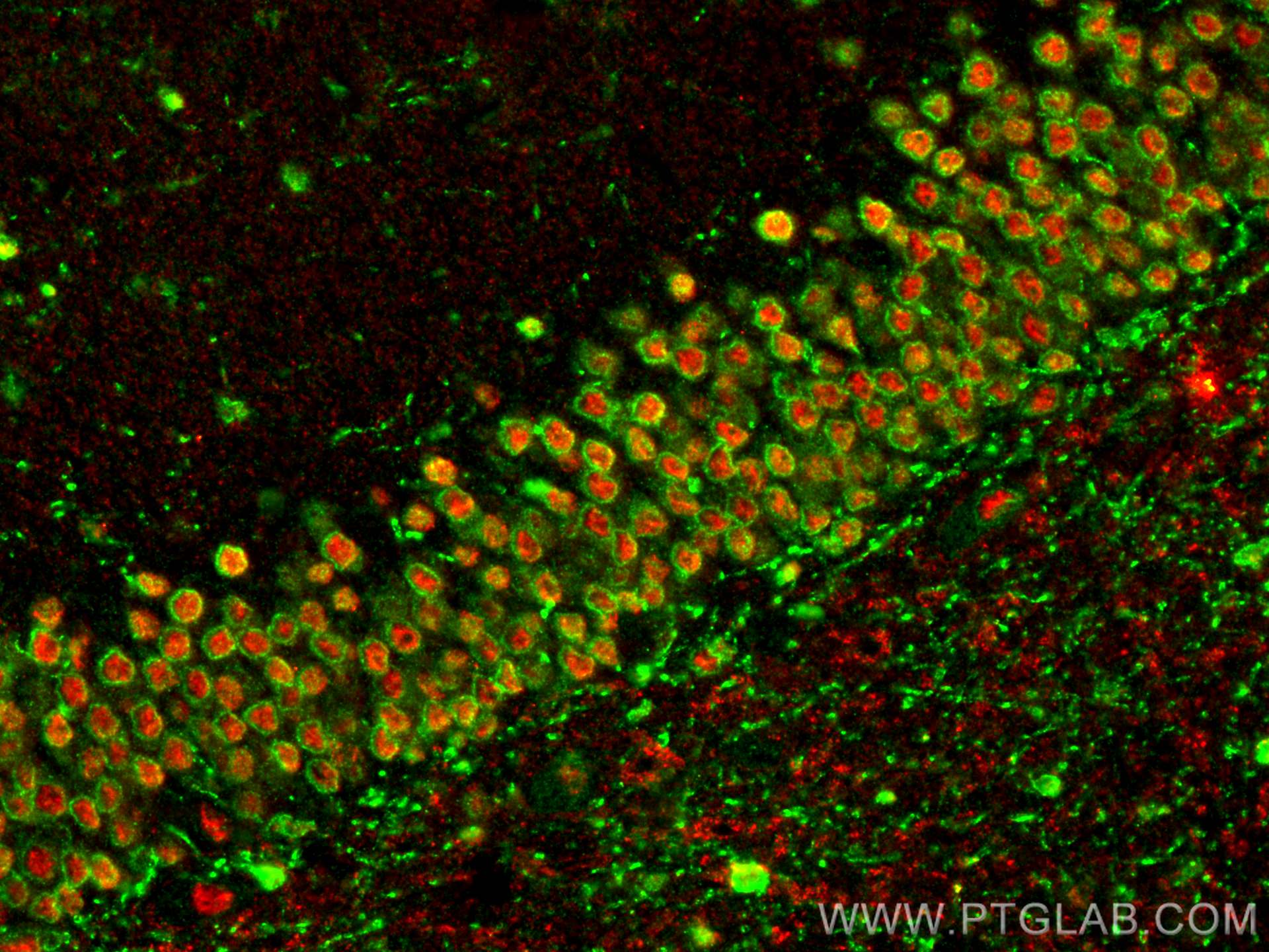 IF Staining of rat brain using 30490-1-AP
