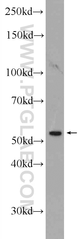 WB analysis of PC-3 using 23955-1-AP