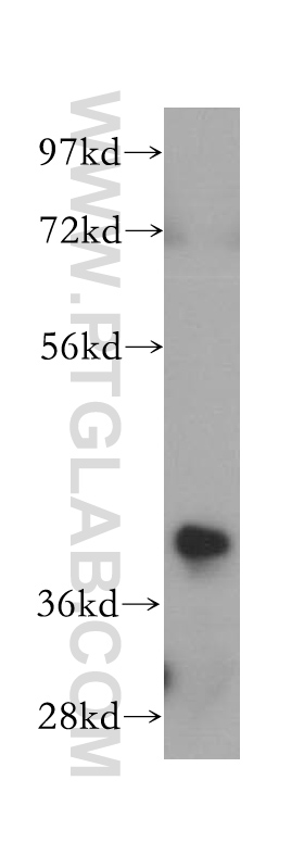 WB analysis of HeLa using 15111-1-AP