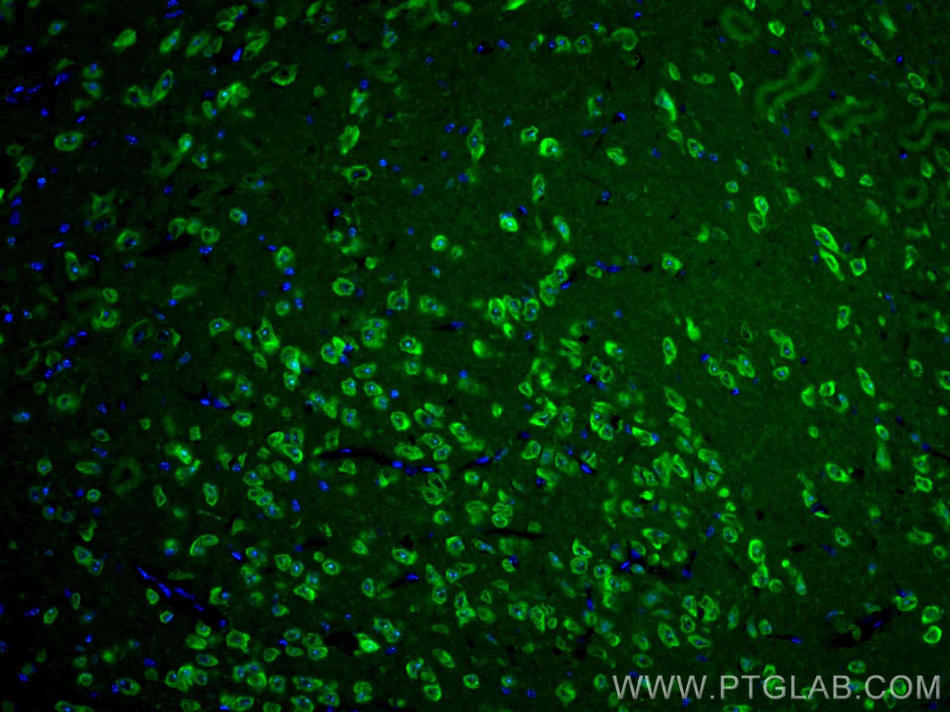 IF Staining of mouse brain using CL488-66150