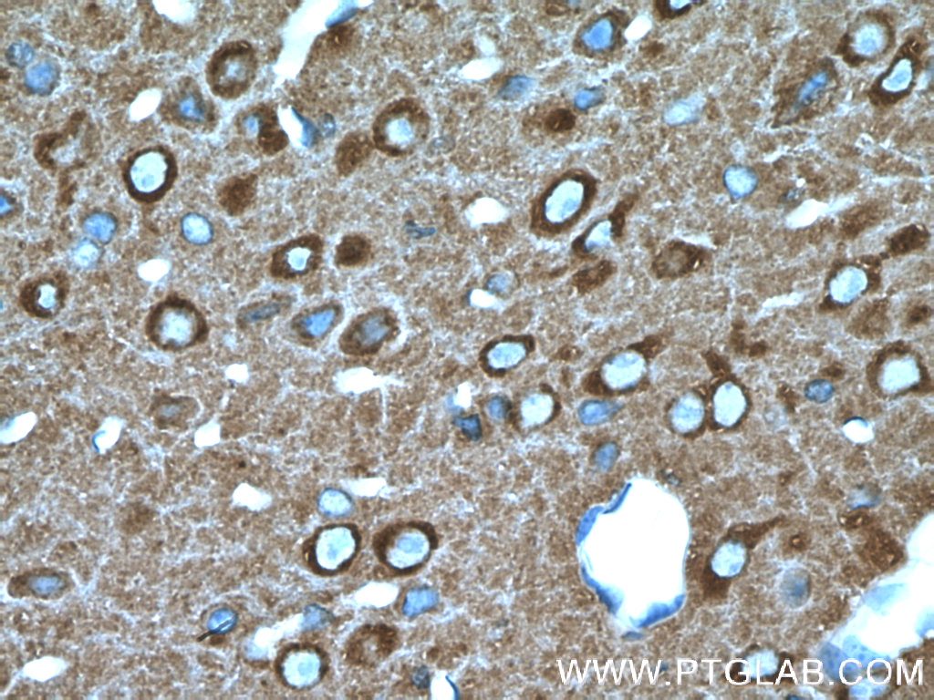IHC staining of mouse brain using 21172-1-AP