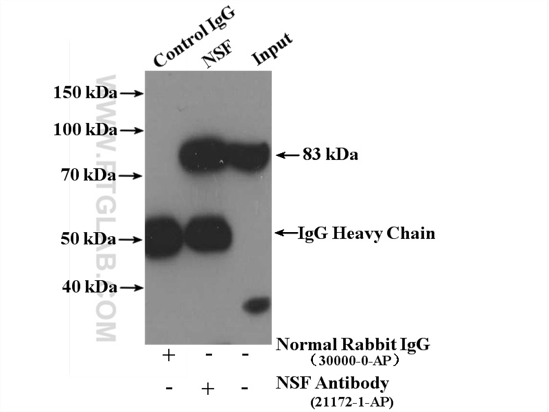 IP experiment of mouse brain using 21172-1-AP