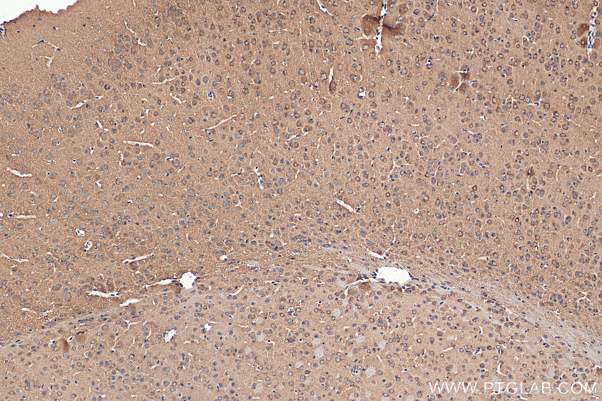 IHC staining of mouse brain using 28837-1-AP