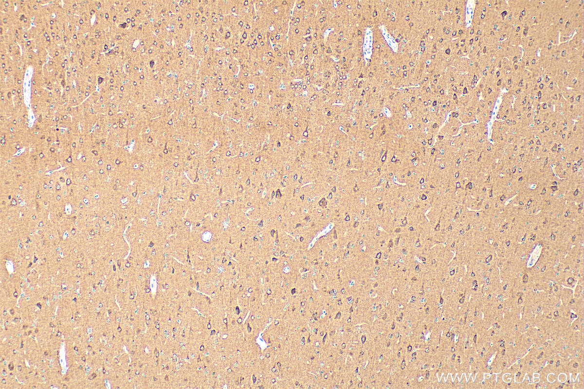 IHC staining of rat brain using 68061-1-Ig (same clone as 68061-1-PBS)