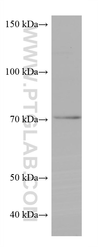 WB analysis of SH-SY5Y using 68061-1-Ig