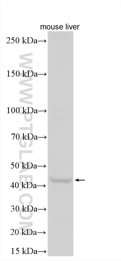 WB analysis using 15620-1-AP WB analysis using 15620-1-AP
