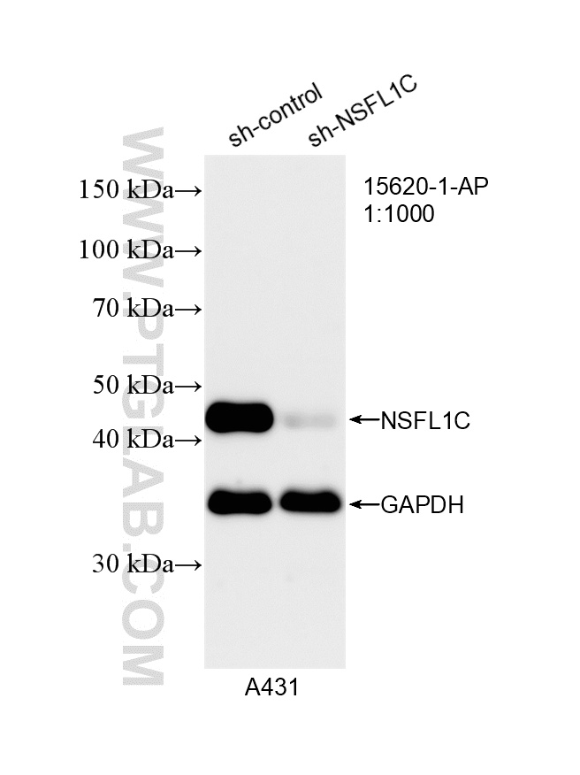 WB analysis of A431 using 15620-1-AP WB analysis of A431 using 15620-1-AP