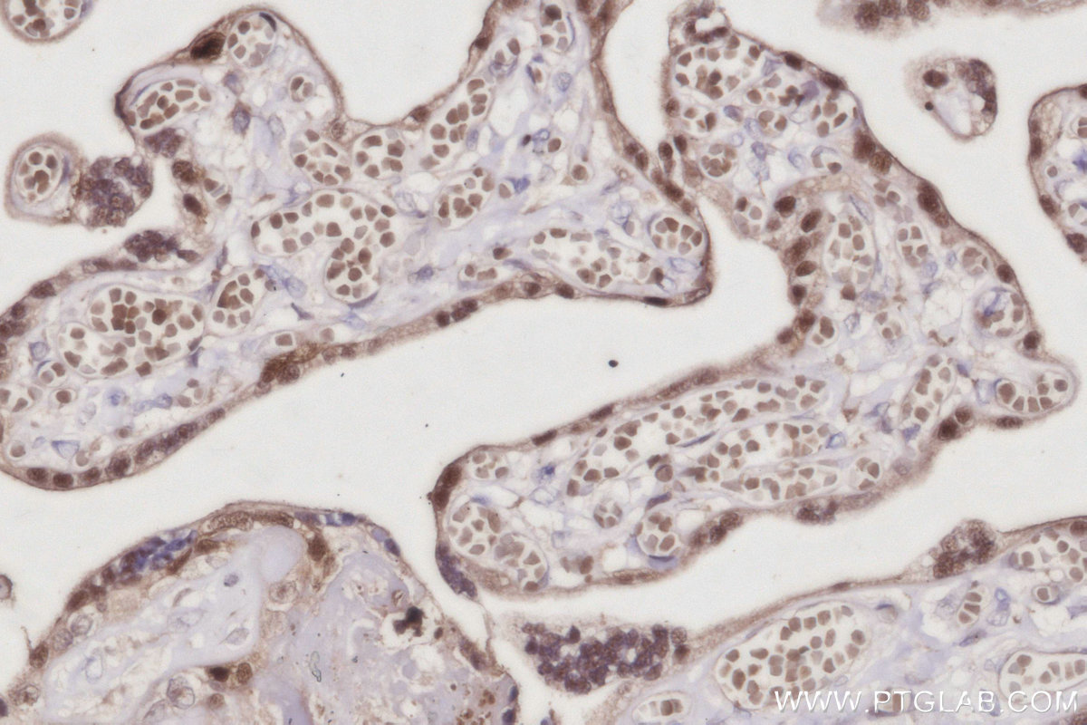 IHC staining of human placenta using 68182-1-Ig IHC staining of human placenta using 68182-1-Ig