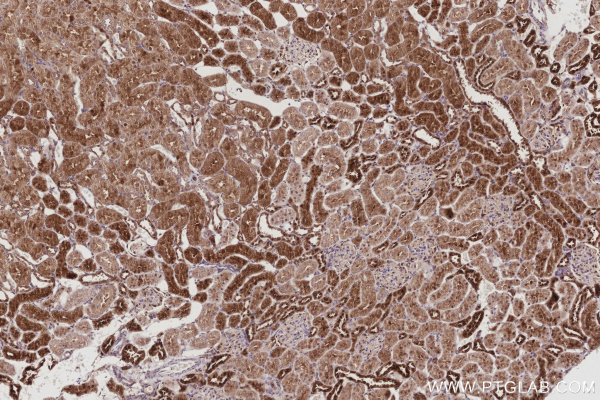 IHC staining of rat kidney using 68182-1-Ig IHC staining of rat kidney using 68182-1-Ig