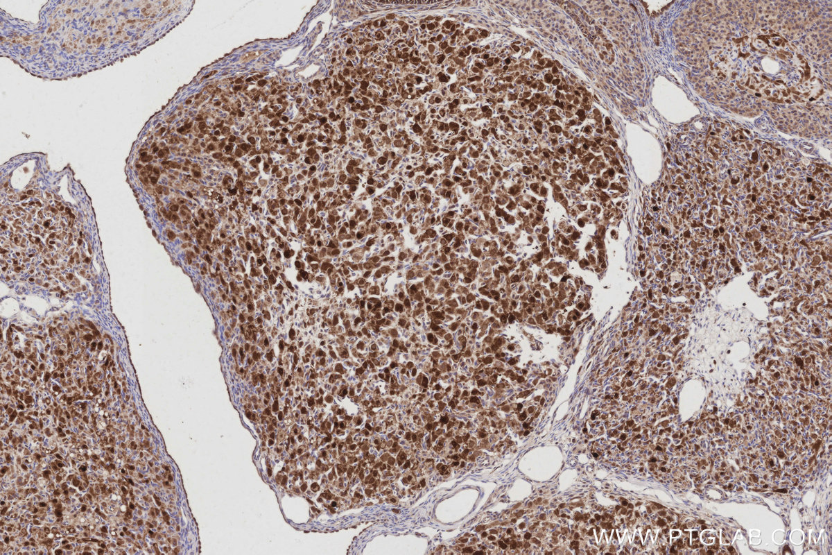 IHC staining of rat ovary using 68182-1-Ig IHC staining of rat ovary using 68182-1-Ig