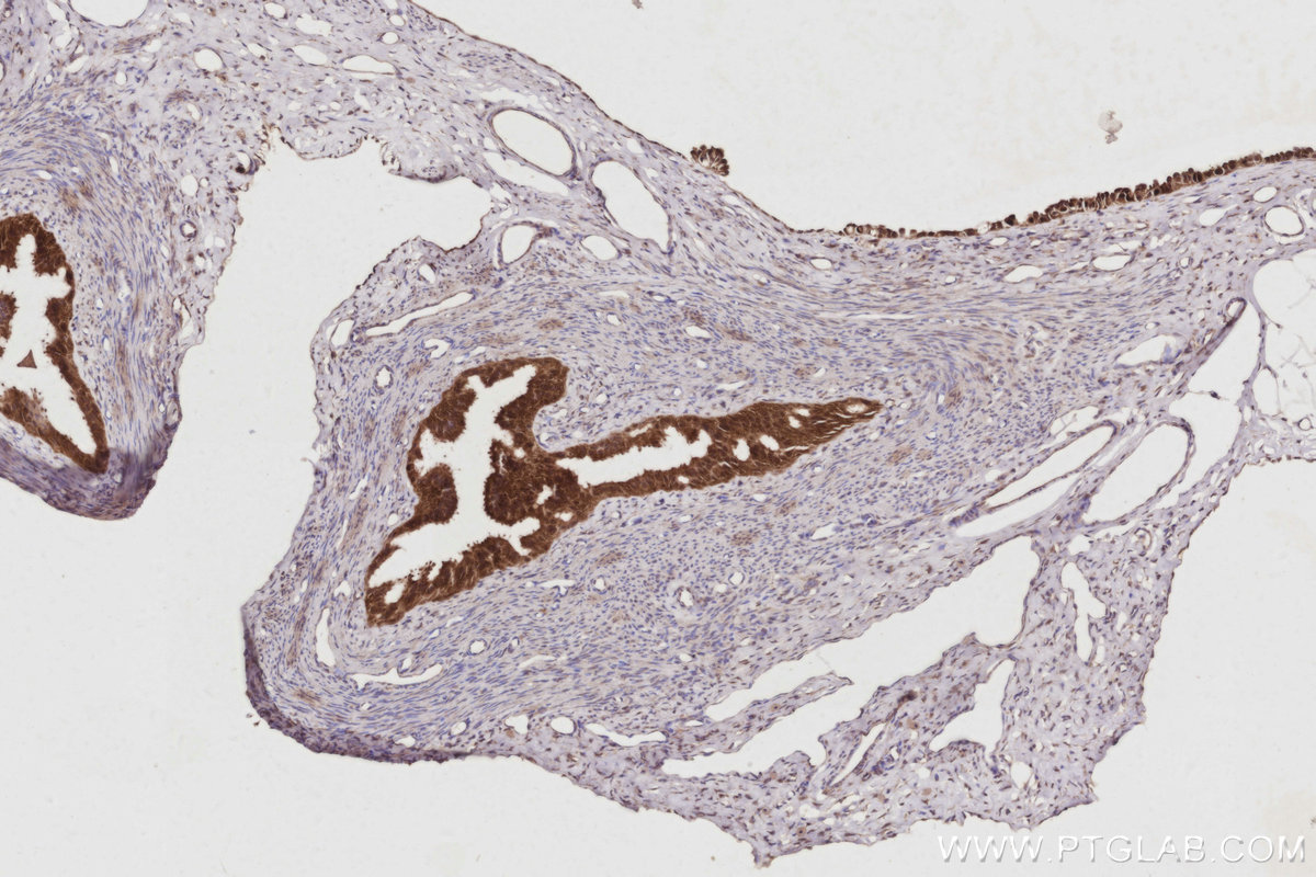 IHC staining of rat ovary using 68182-1-Ig IHC staining of rat ovary using 68182-1-Ig