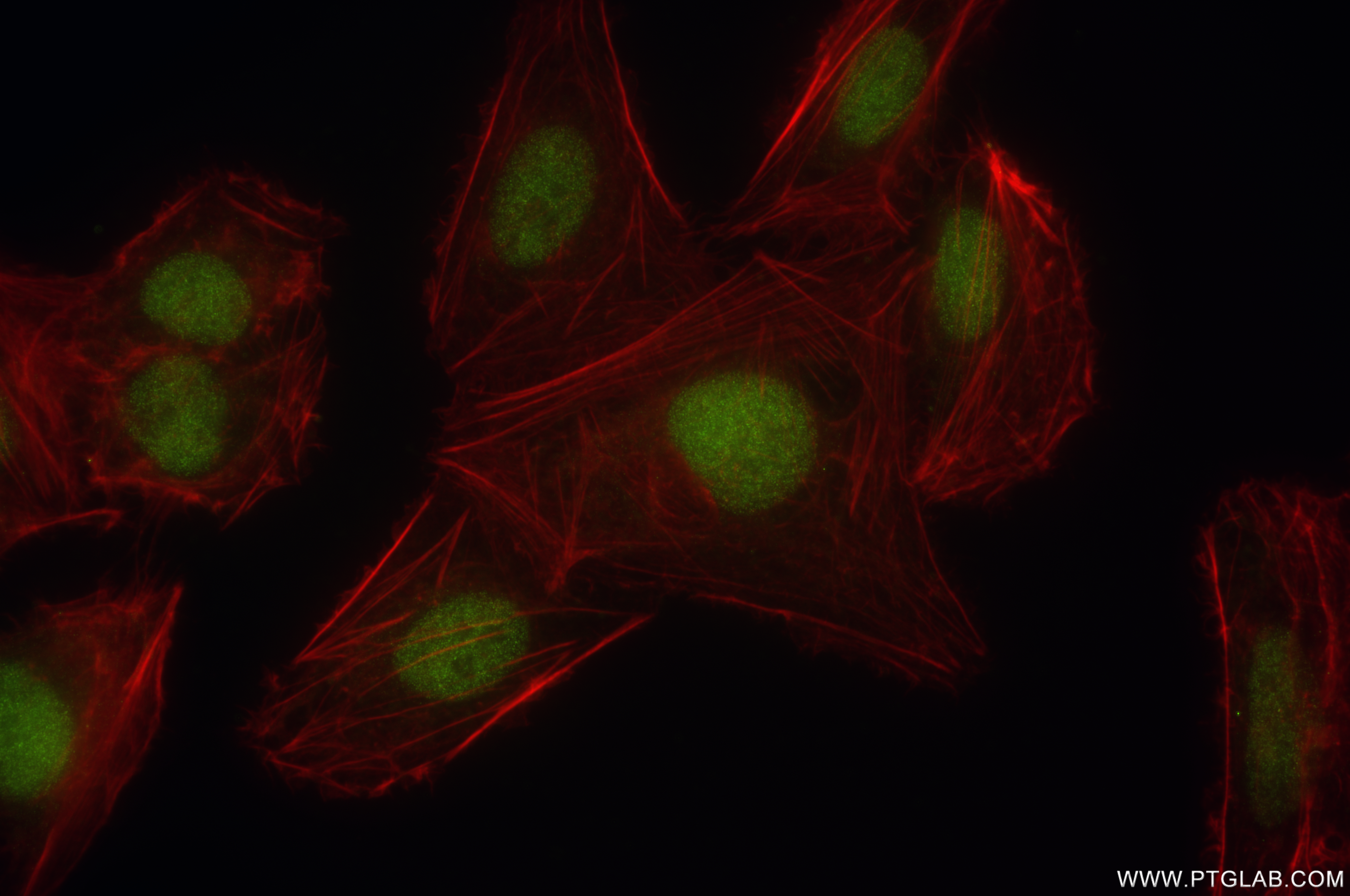 IF Staining of U2OS using 85188-4-RR (same clone as 85188-4-PBS)