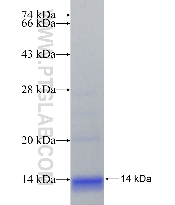 NSP7 fusion protein Ag30907 SDS-PAGE NSP7 fusion protein Ag30907 SDS-PAGE
