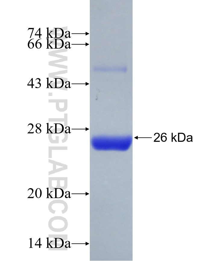 NSP8 fusion protein Ag30906 SDS-PAGE NSP8 fusion protein Ag30906 SDS-PAGE
