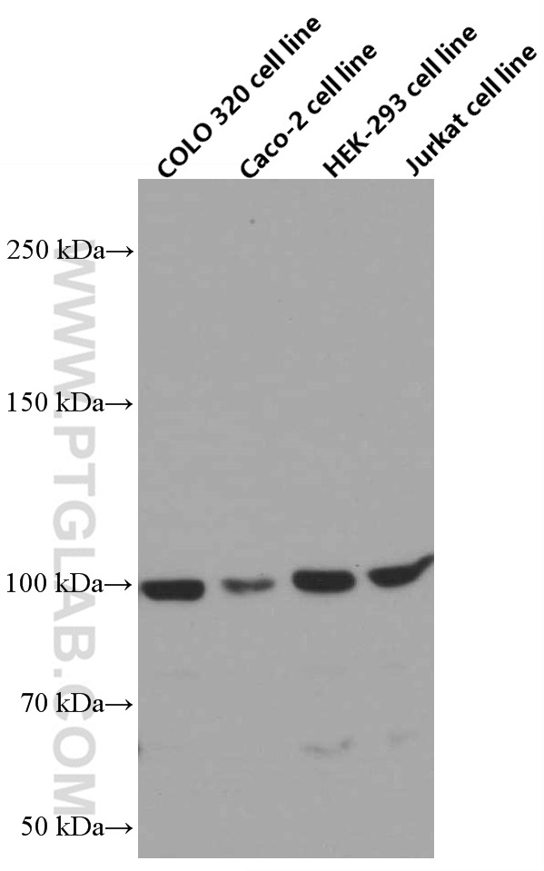 WB analysis of COLO 320 using 66580-1-Ig