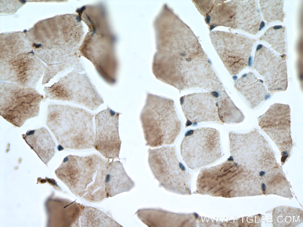 IHC staining of mouse skeletal muscle using 15449-1-AP