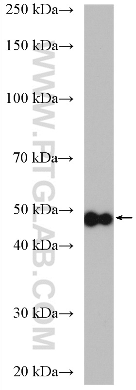 WB analysis of HeLa using 15449-1-AP