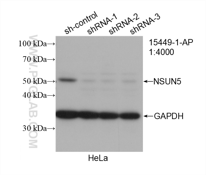 WB analysis of HeLa using 15449-1-AP