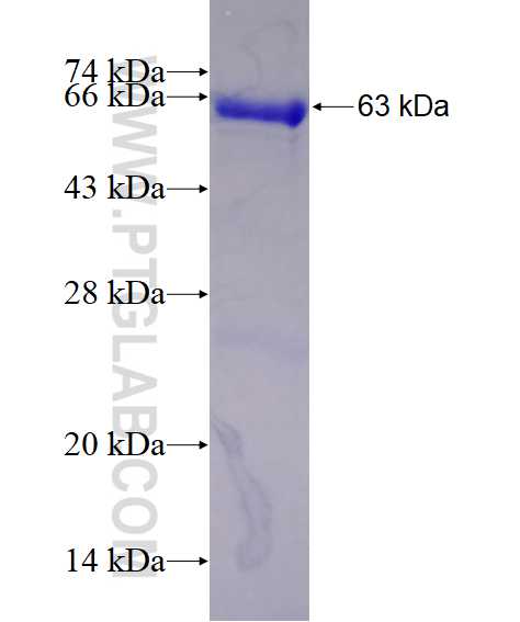 NSUN5 fusion protein Ag7711 SDS-PAGE