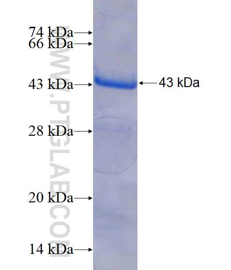 NSUN5 fusion protein Ag7868 SDS-PAGE NSUN5 fusion protein Ag7868 SDS-PAGE