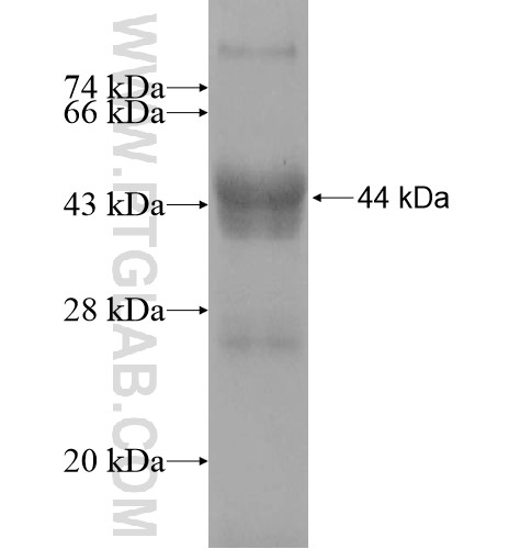 NSUN6 fusion protein Ag11109 SDS-PAGE NSUN6 fusion protein Ag11109 SDS-PAGE