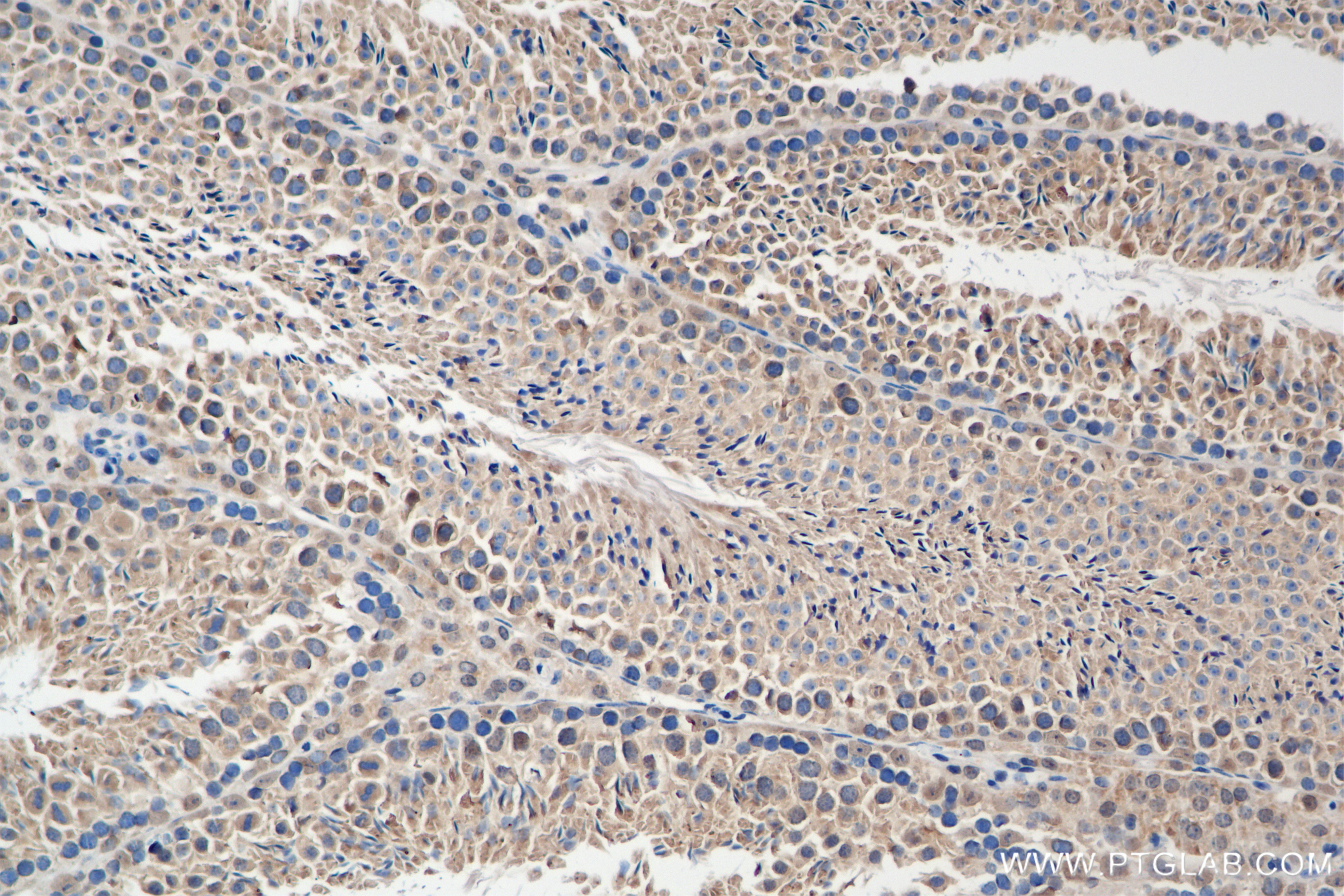 IHC staining of mouse testis using 84795-1-RR (same clone as 84795-1-PBS)