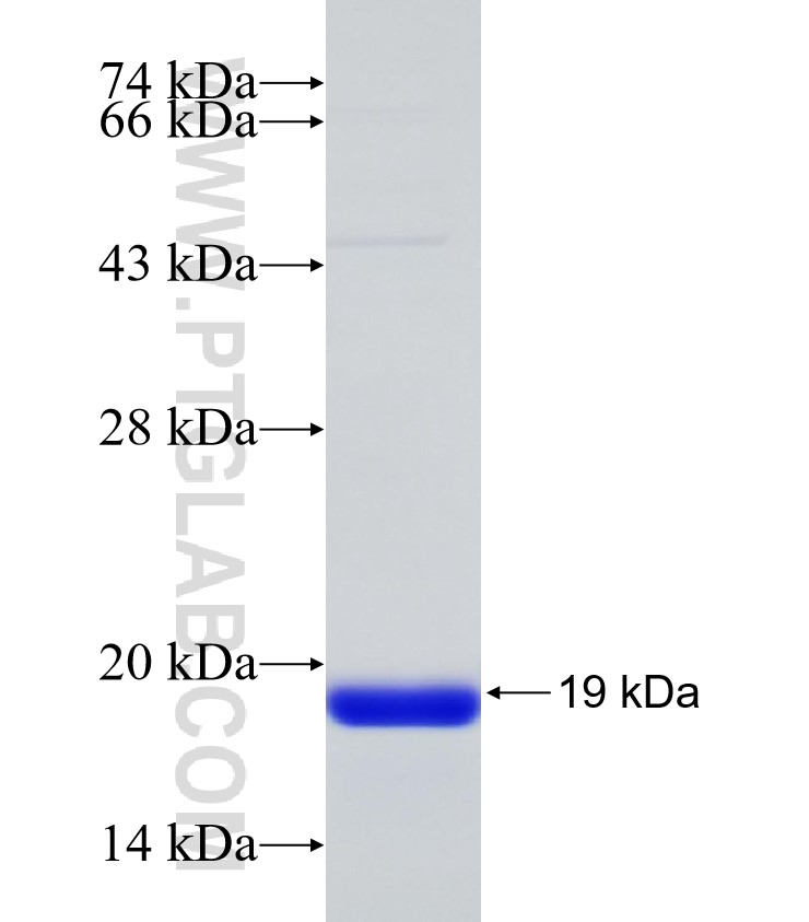 NSUN7 fusion protein Ag31872 SDS-PAGE NSUN7 fusion protein Ag31872 SDS-PAGE