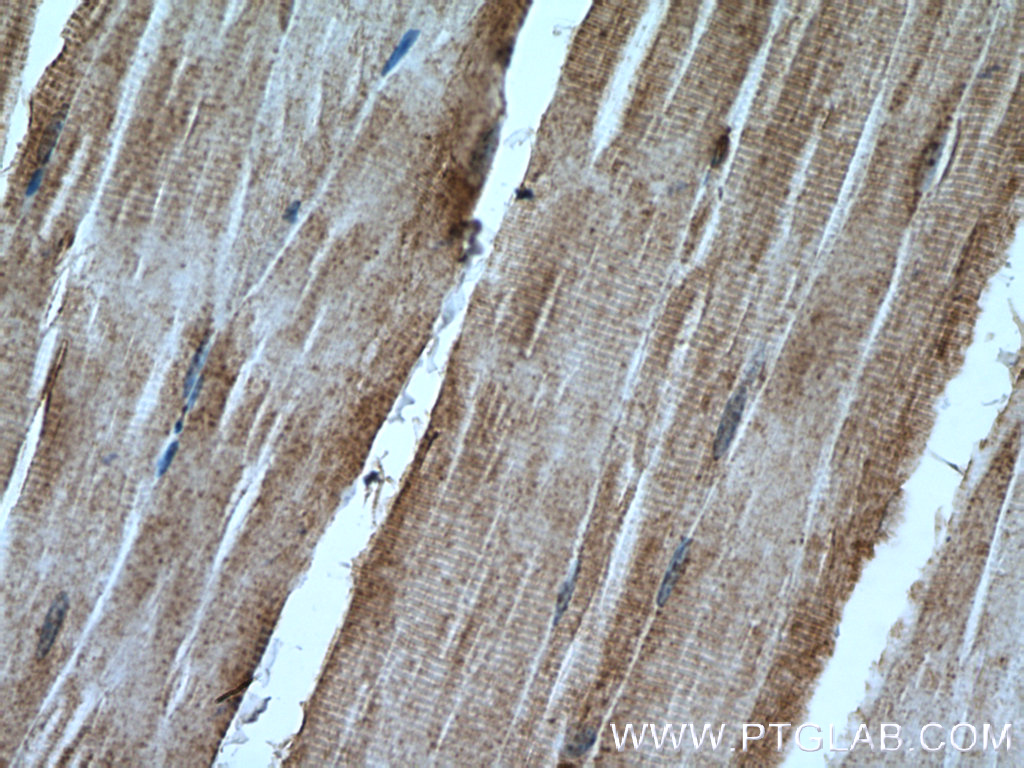 IHC staining of mouse skeletal muscle using 16577-1-AP