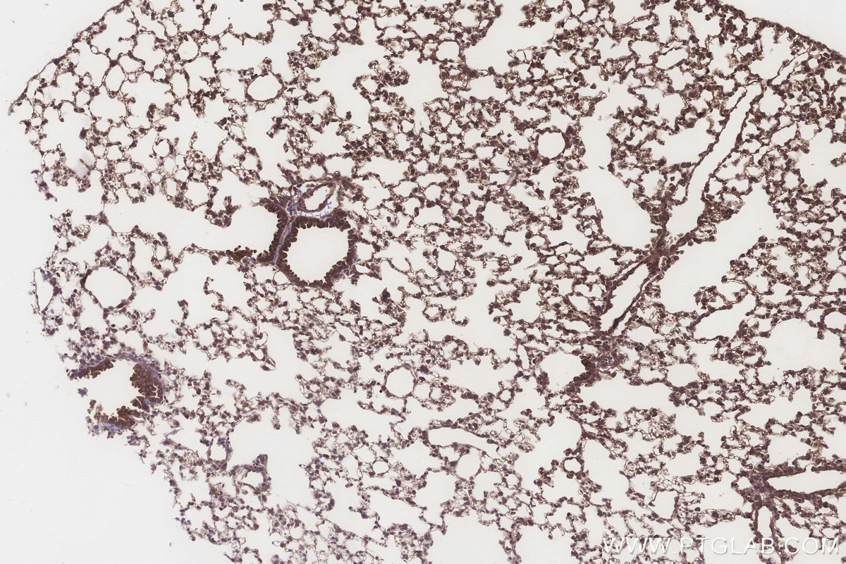IHC staining of mouse lung using 15223-1-AP IHC staining of mouse lung using 15223-1-AP