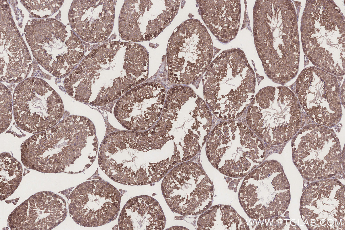 IHC staining of mouse testis using 15223-1-AP IHC staining of mouse testis using 15223-1-AP