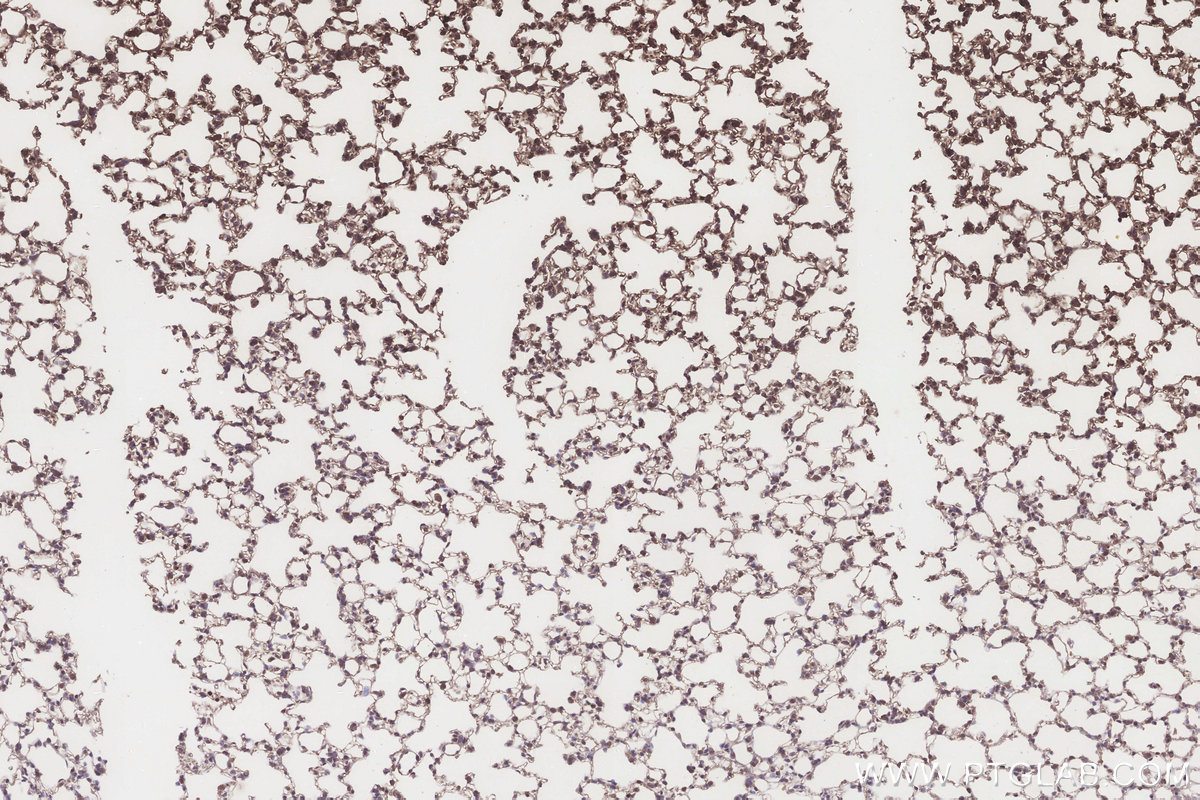 IHC staining of mouse lung using 15223-1-AP IHC staining of mouse lung using 15223-1-AP