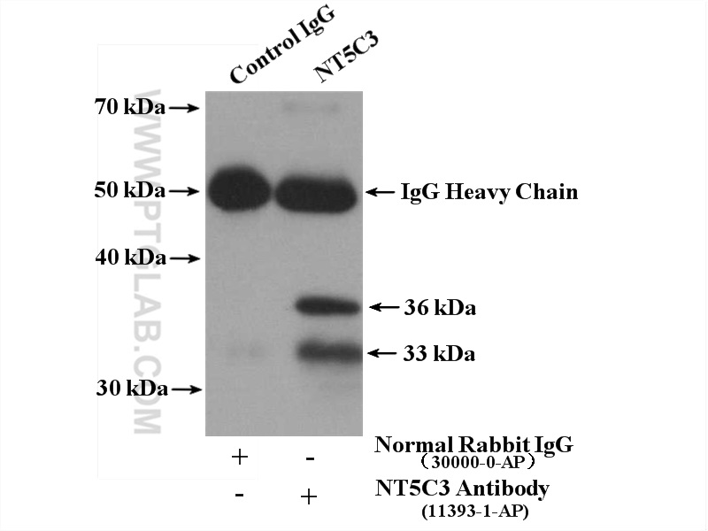 IP experiment of mouse kidney using 11393-1-AP